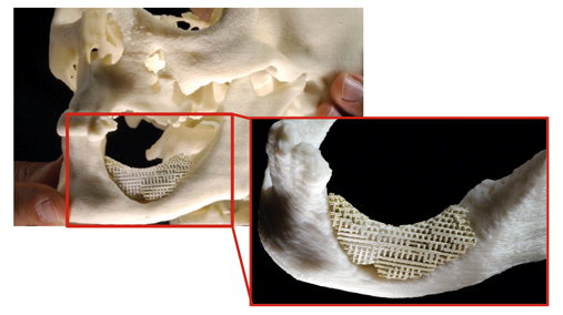 Cornell Develops Foam Artificial Heart