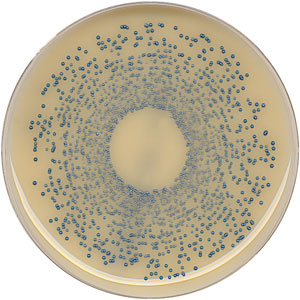 Oxoid Brilliance MRSA Agar Is Ideal For MRSA Screening