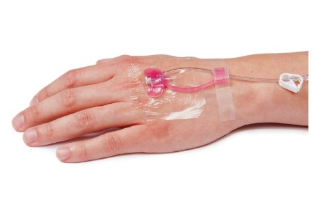 Tangent Medical Announces US Launch Of The NovaCath