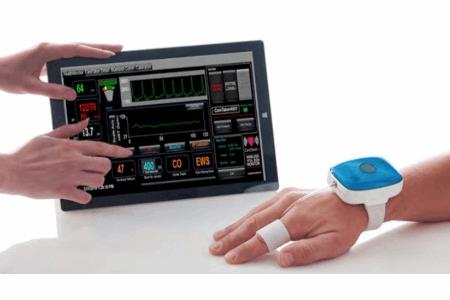 A Low-Cost Wristwatch for Non-Invasive Continuous Blood Pressure Monitoring