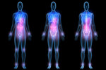 GettyImages-1455726726 pain body map