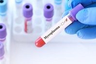 GettyImages-1489353864-vial-mycoplasma-gloved-hand