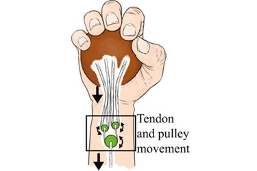 TendonandPulleyMovement TendonandPulleyMovement