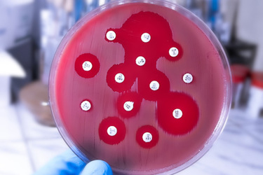 Antibiotic resistance of bacteria-GettyImages-2195700743 Antibiotic resistance of bacteria-GettyImages-2195700743