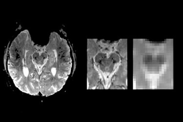 Northeastern University human brain stem images Northeastern University human brain stem images