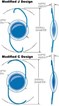 Three Piece Posterior Chamber Biconvex Lenses Three Piece Posterior Chamber Biconvex Lenses