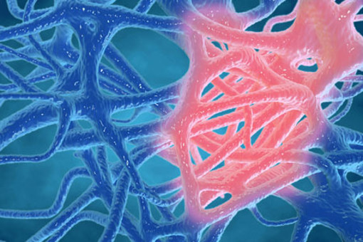 Inflammation-GettyImages-1147468451