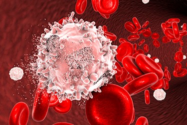 A Game Changer for Blood Cancer Treatment