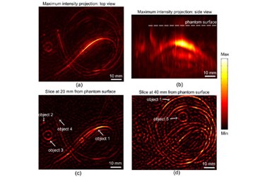 Imaging Breast Cancer With Light