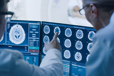How An External Control Arm Changed Phase 3 Trials For Brain Cancer - Vimarsana News