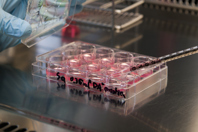 Improved GLP-1 Receptor Agonist Peptide Recovery GettyImages-178483185 assay