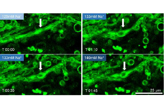 Sub 50 Femtosecond Pulse Lasers For Gentler Multiphoton Microscopy