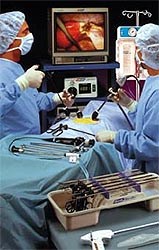 Selected Laparoscopic Products