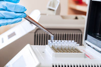 Replacement Of Traditional Adventitious Virus Testing GettyImages-177310452-PCR-method-dna-sequencing-glove