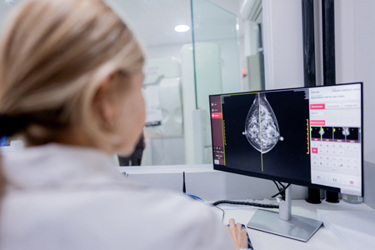 Doctor examining mammography-GettyImages-2274267549