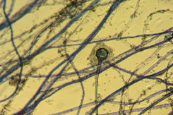 Fungal Hyphae and Sporangium Under Microscope-GettyImages-2217760991