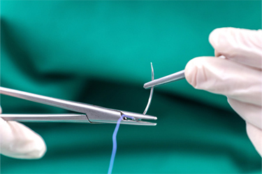 GettyImages-1064776822-sugical-sutures GettyImages-1064776822-sugical-sutures