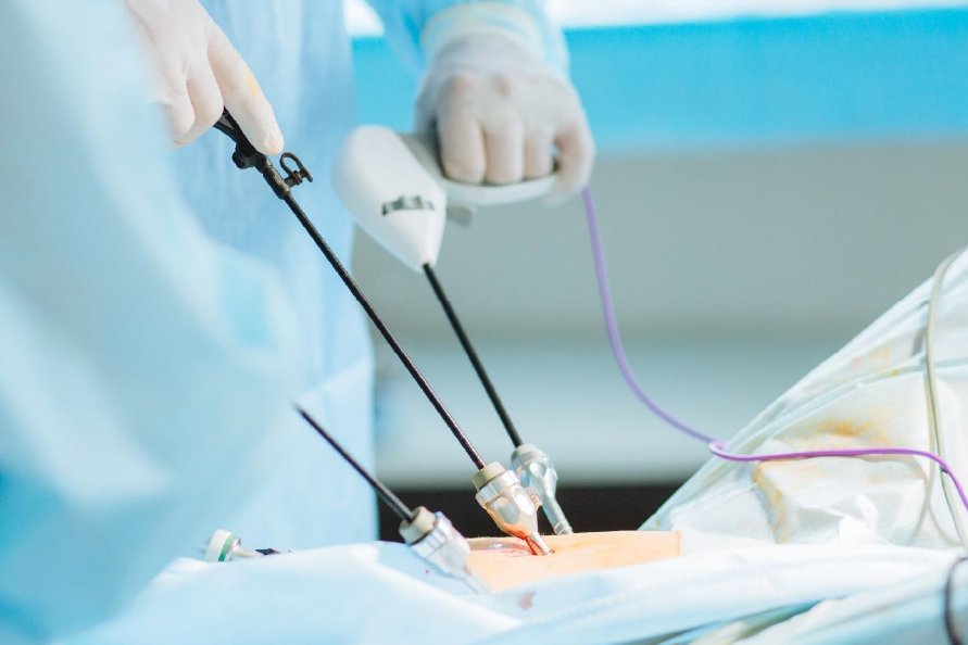 piezo-handpieces-for-ultrasonic-surgery