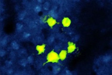 Optogenetics Optogenetics