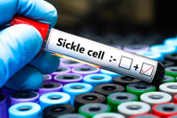 GettyImages-1824452072-sickle-cell-blood-sample-vial-gloved-hand