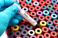 Polio Possitive-GettyImages-816394344