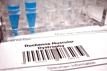 Duchenne muscular dystrophy genetic test GettyImages-1042202100