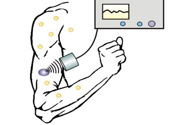 Zhen-Gu_Ultrasound