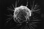 cancer_cell_publicdomain