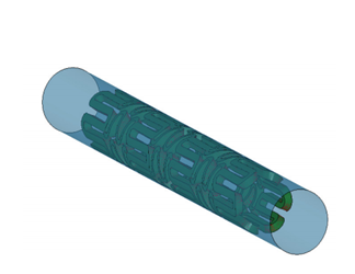 Parameterization And Optimization Of Balloon Expandable Stent Parameterization And Optimization Of Balloon Expandable Stent