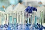 GettyImages-2180157480 lab worker test tubes