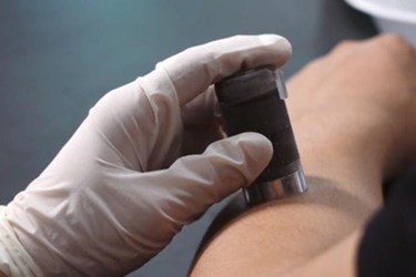 College Freshmen Develop Single-Use Numbing Device To Lessen Injection Pain