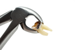 Can We Eradicate Tech Transfer? Pulling Teeth