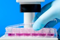 Cell Culture Media Fingerprinting GettyImages-171223483-cell-culture-microscope-assay