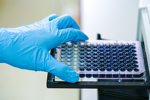 What FDA CRLs Reveal About Cell-Based Potency Assays_Solvias