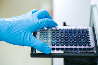 What FDA CRLs Reveal About Cell-Based Potency Assays_Solvias