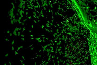 ui-bioactive-gel ui-bioactive-gel