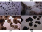 0128-LUNG-four-med-310x234.jpg