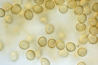 Spores of a slime mold GettyImages-898263496