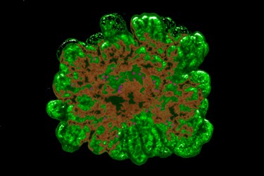 Miniature Pancreas Miniature Pancreas