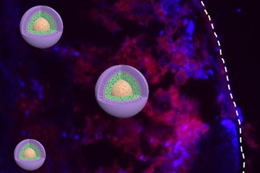 nanoparticle nanoparticle