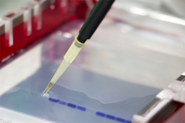 GettyImages-883964436-liquid-electrophoresis-western-blotting GettyImages-883964436-liquid-electrophoresis-western-blotting
