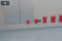 BioTitan Retention Device Overview