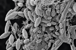 3-SEM biofilm on stainless steel surface