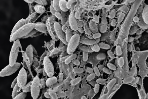 3-SEM biofilm on stainless steel surface