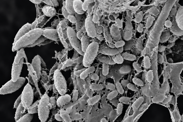 3-SEM biofilm on stainless steel surface