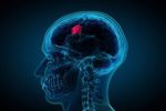 GettyImages-475447149-brain_neurology_glioblastoma