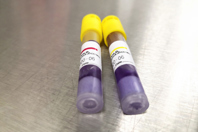 GettyImages-1187680225-metal-table-biological-indicator