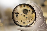 GettyImages-109727565 mold