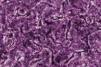 Emulate - organ chips_intestine