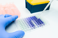 Why Is Custom Cell Culture Media So Important? Getty 1369755276 - pipette - lysate - protein